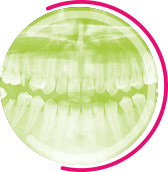 image Radiologie dentaire ConeBeam