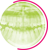 RADIOLOGIE DENTAIRE CONEBEAM