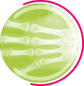 RADIOGRAPHIE